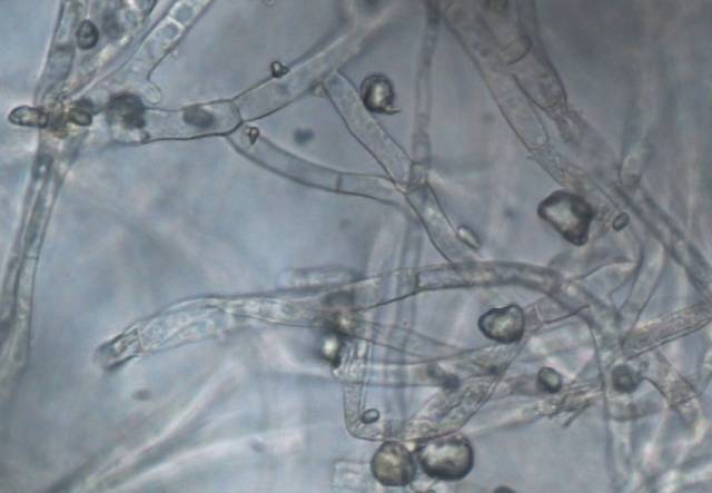 Schimmelpilze können effizient Mikroplastik binden