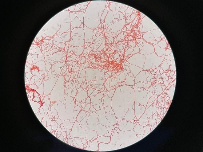 <p>Mikroskopieaufnahme des Mikroorganismus <em>T. Mirandus</em>, dieser produziert unter speziellen Kultivierungsbedingungen Wasserstoff. © MCI</p><p><span sans-serif=